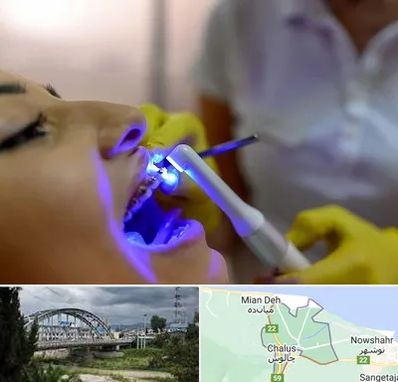 دندانپزشکی با لیزر در چالوس