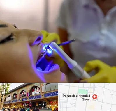 دندانپزشکی با لیزر در 15 خرداد