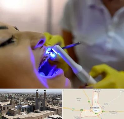 دندانپزشکی با لیزر در سبزوار