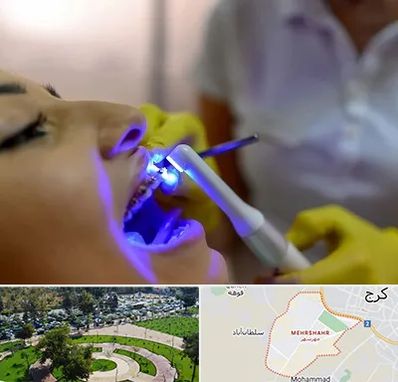 دندانپزشکی با لیزر در مهرشهر کرج 