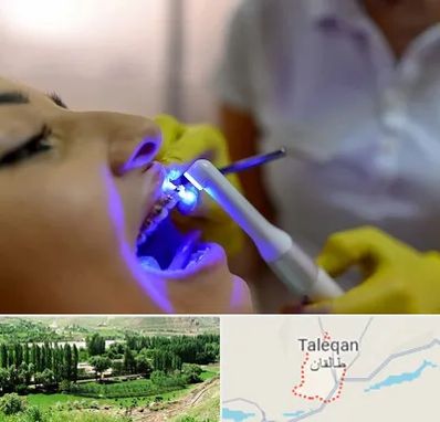 دندانپزشکی با لیزر در طالقان