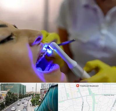 دندانپزشکی با لیزر در بلوار فرحزادی