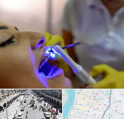 دندانپزشکی با لیزر در نادری اهواز