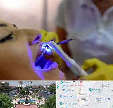 دندانپزشکی با لیزر در بهارستان 