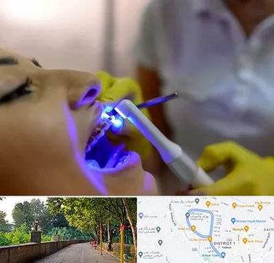 دندانپزشکی با لیزر در فلکه گاز رشت