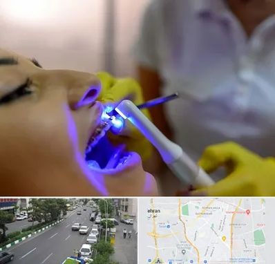 دندانپزشکی با لیزر در ستارخان 