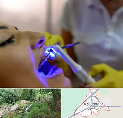 دندانپزشکی با لیزر در آزادشهر