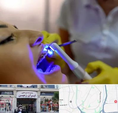 دندانپزشکی با لیزر در ایران زمین