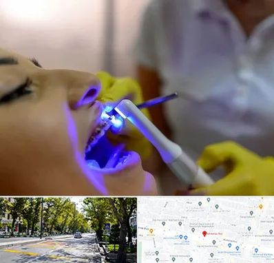 دندانپزشکی با لیزر در میرداماد