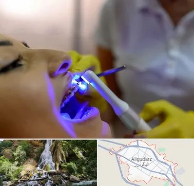 دندانپزشکی با لیزر در الیگودرز