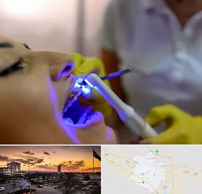 دندانپزشکی با لیزر در قوچان