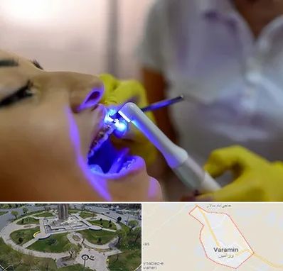 دندانپزشکی با لیزر در ورامین