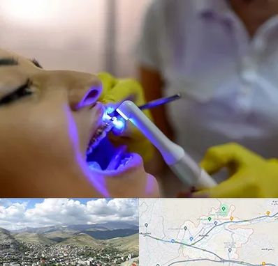 دندانپزشکی با لیزر در رودهن