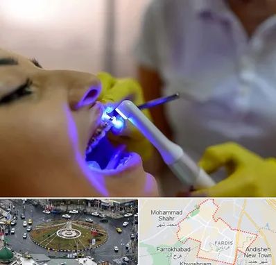 دندانپزشکی با لیزر در فردیس کرج 