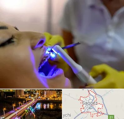 دندانپزشکی با لیزر در سقز