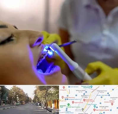 دندانپزشکی با لیزر در شریعتی 