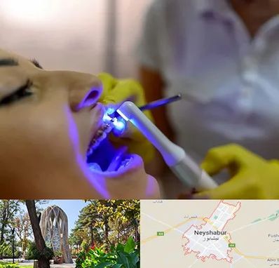 دندانپزشکی با لیزر در نیشابور