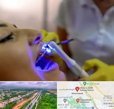 دندانپزشکی با لیزر در قصرالدشت شیراز