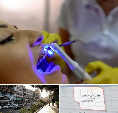 دندانپزشکی با لیزر در خیابان جمالزاده