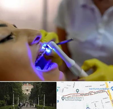 دندانپزشکی با لیزر در بلوار معلم رشت 