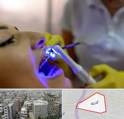 دندانپزشکی با لیزر در آذری