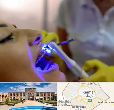 دندانپزشکی با لیزر در کرمان