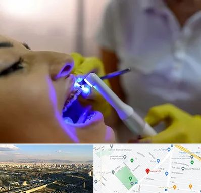 دندانپزشکی با لیزر در هنگام