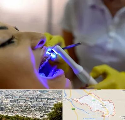 دندانپزشکی با لیزر در یاسوج