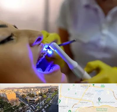 دندانپزشکی با لیزر در تهرانپارس 