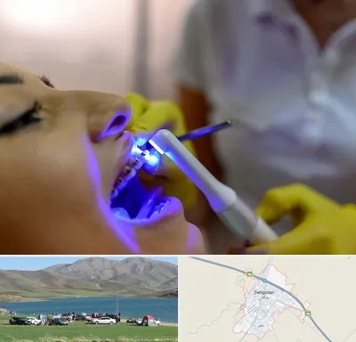 دندانپزشکی با لیزر در دهگلان