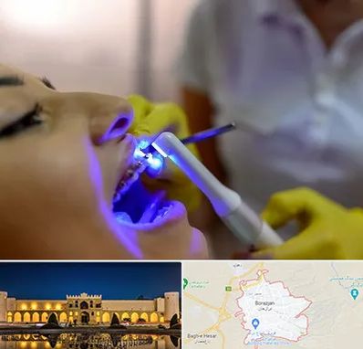 دندانپزشکی با لیزر در برازجان
