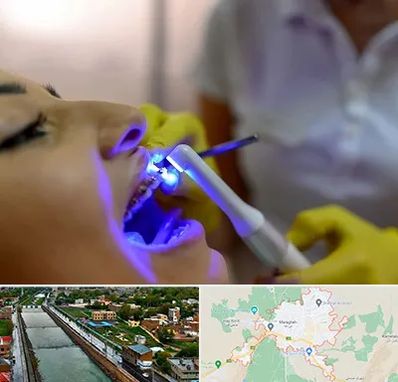 دندانپزشکی با لیزر در مراغه