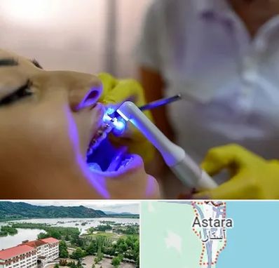 دندانپزشکی با لیزر در آستارا