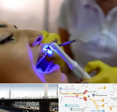 دندانپزشکی با لیزر در پارک وی 