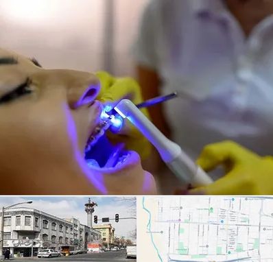 دندانپزشکی با لیزر در 17شهریور