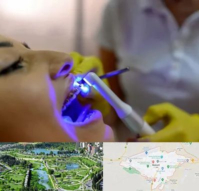 دندانپزشکی با لیزر در بجنورد