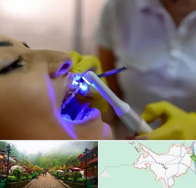 دندانپزشکی با لیزر در فومن