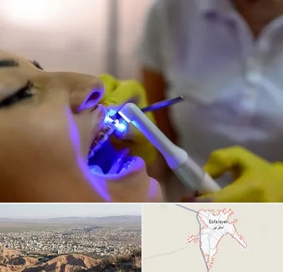 دندانپزشکی با لیزر در اسفراین