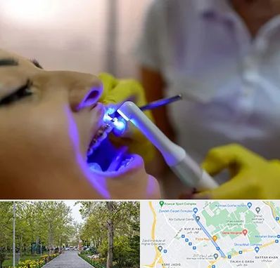 دندانپزشکی با لیزر در قدوسی غربی شیراز