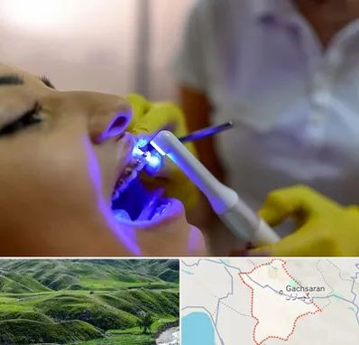 دندانپزشکی با لیزر در گچساران