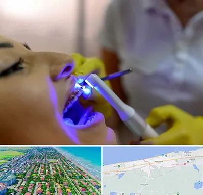 دندانپزشکی با لیزر در فریدونکنار