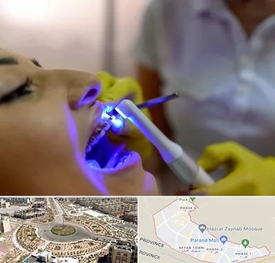 دندانپزشکی با لیزر در پرند