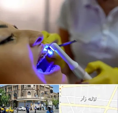 دندانپزشکی با لیزر در لاله زار