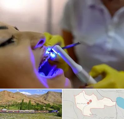 دندانپزشکی با لیزر در خاش