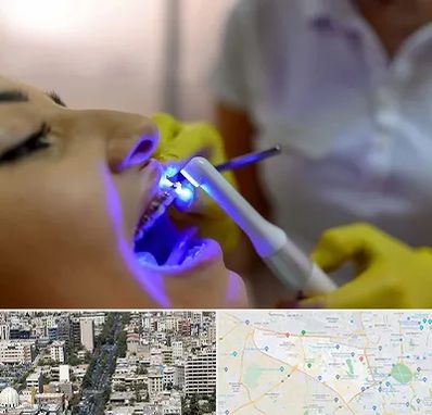 دندانپزشکی با لیزر در منطقه 18 تهران