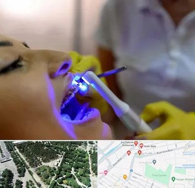 دندانپزشکی با لیزر در سالاریه قم