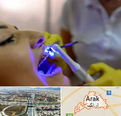 دندانپزشکی با لیزر در اراک