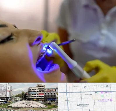 دندانپزشکی با لیزر در مرکز تهران