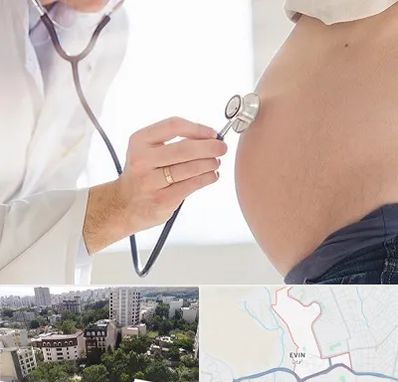 آزمایش غربالگری در اوین