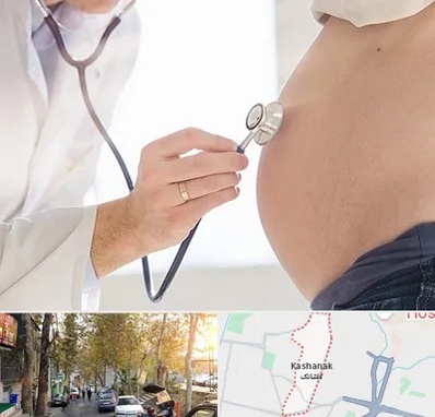 آزمایش غربالگری در کاشانک